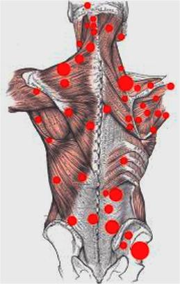 Women holding aching shoulder with pain shown in red.